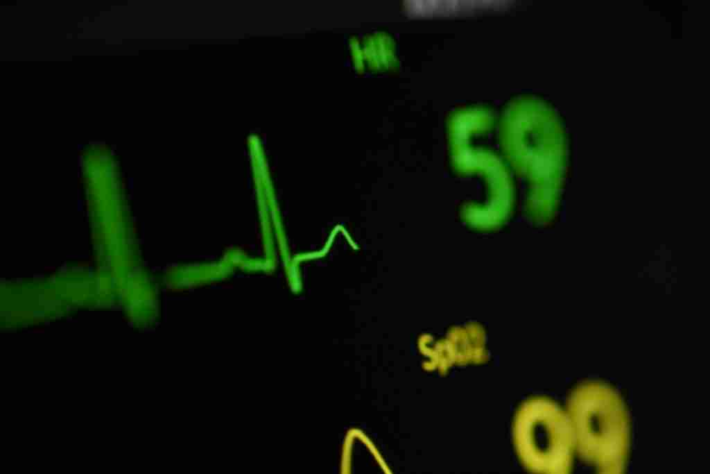 ecg